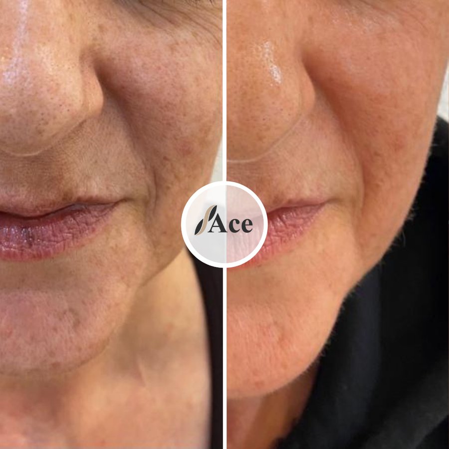 Ace Aesthetics - Ace Aesthetics